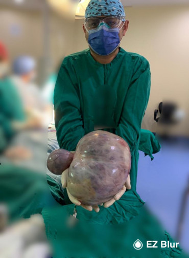 Cirugía de tumor de ovario